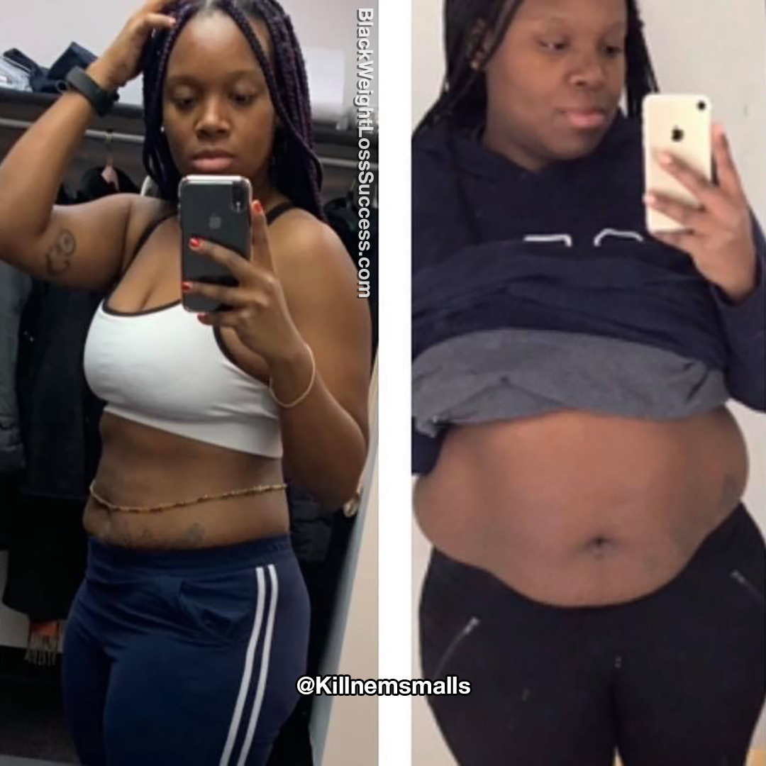 Cherise before and after