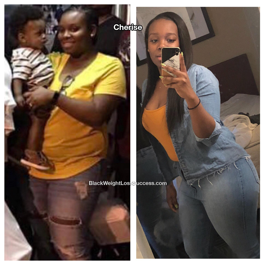 cherise before and after
