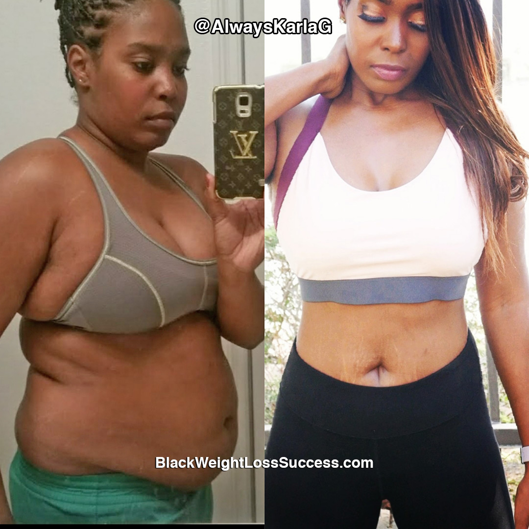 karla before and after