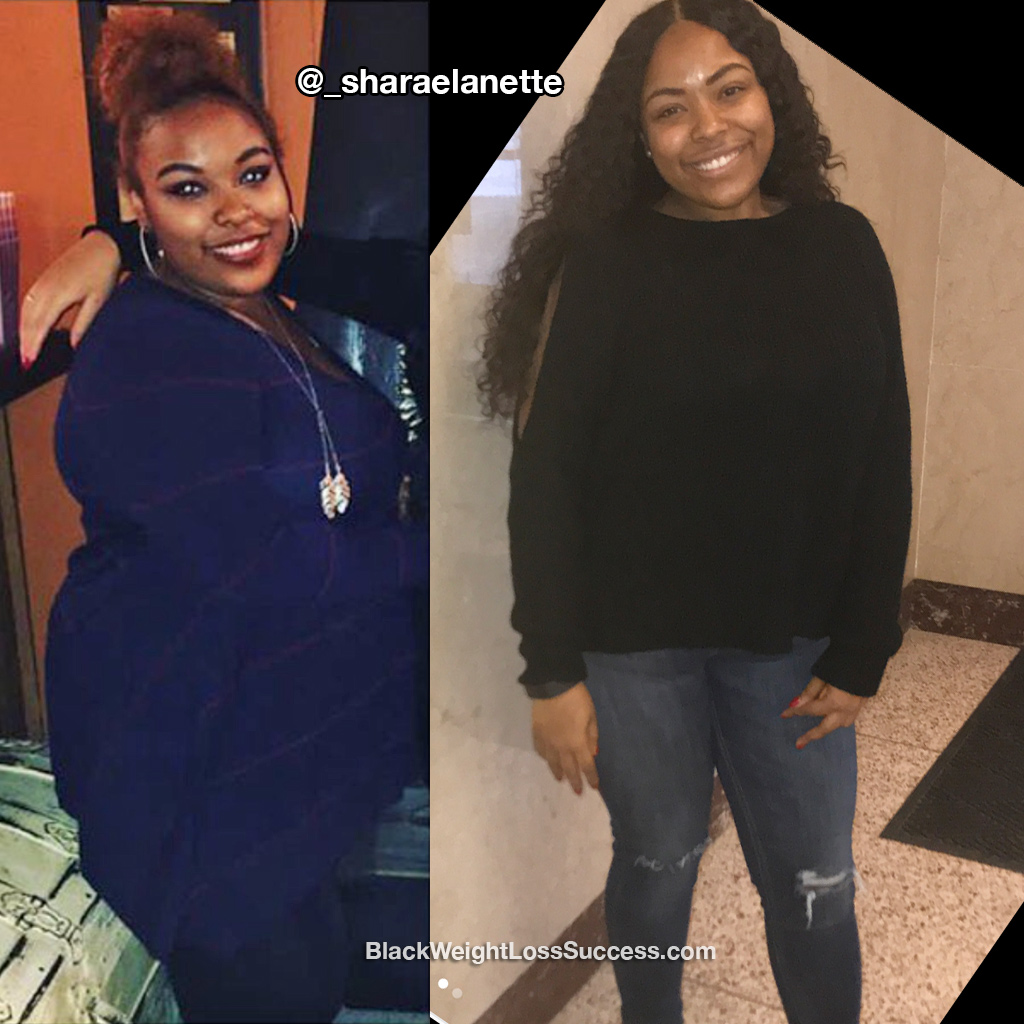 sharae before and after