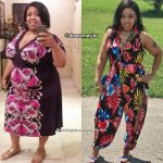 Deasa before and after weight loss surgery