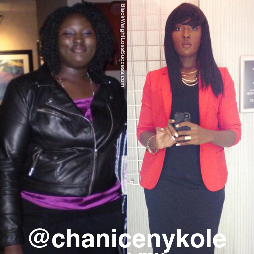 Chanice before and after