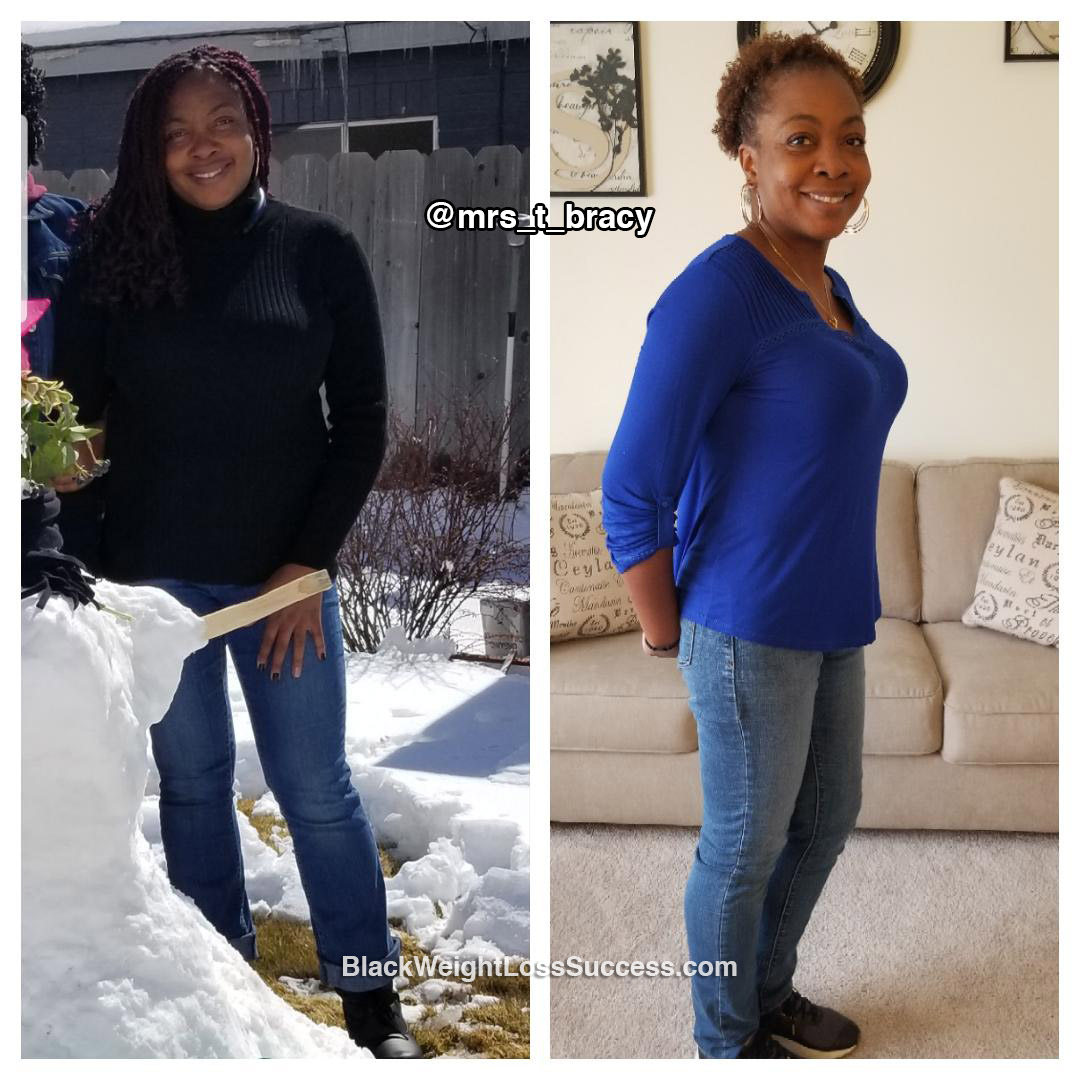 Theresa before and after