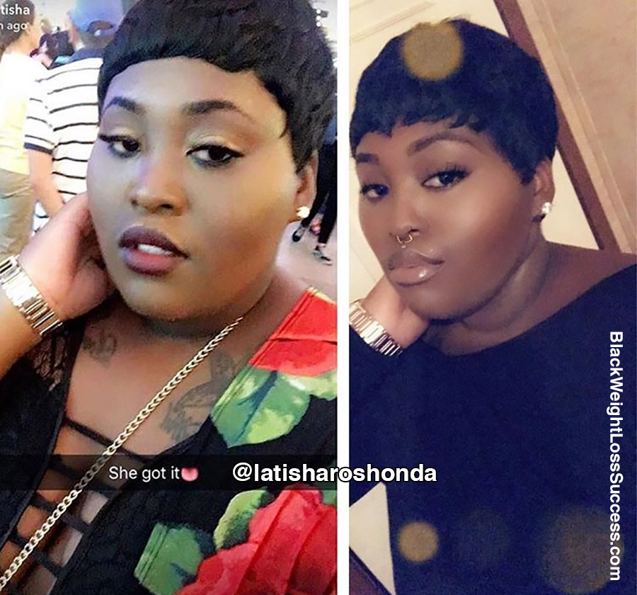 Latisha before and after