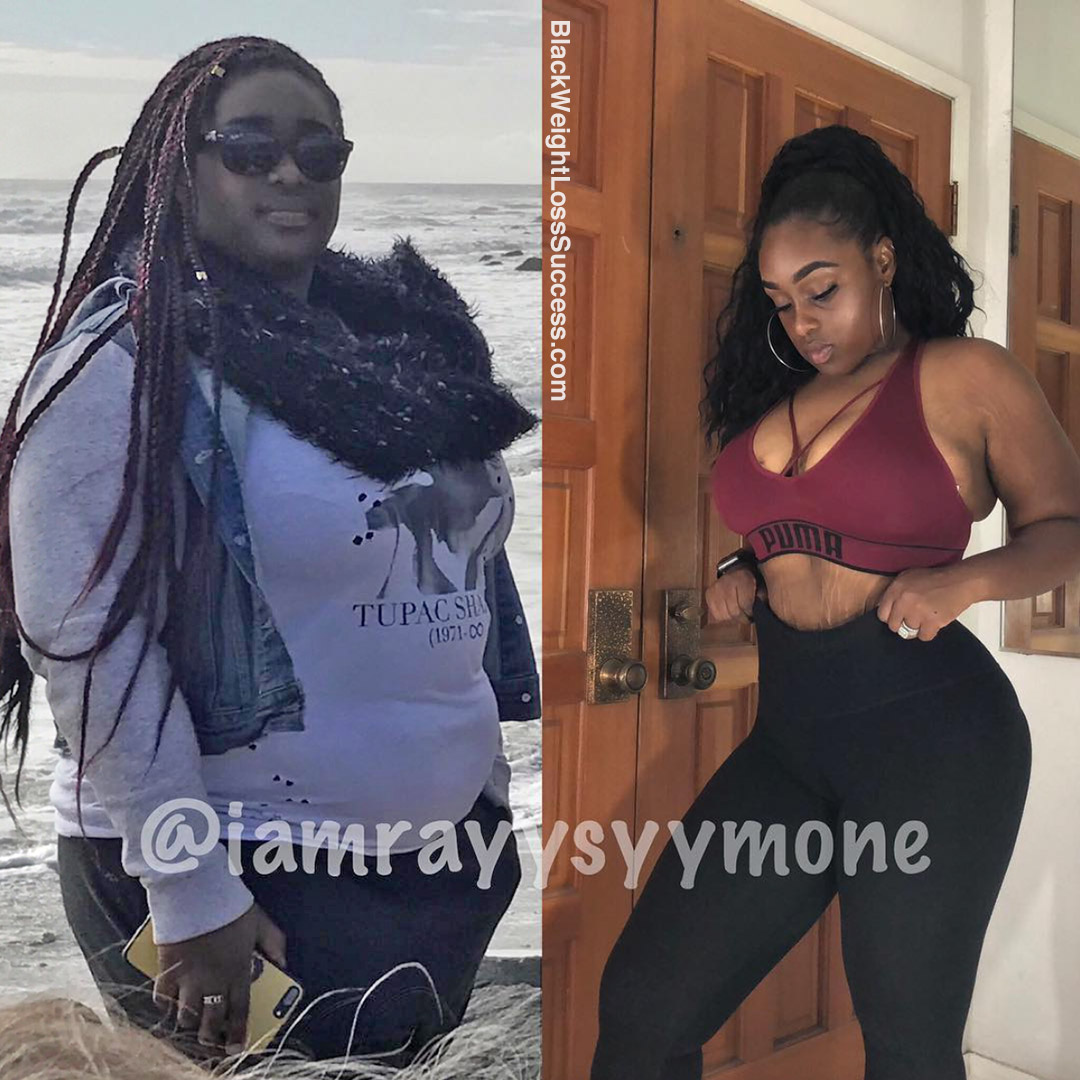 Rayy before and after