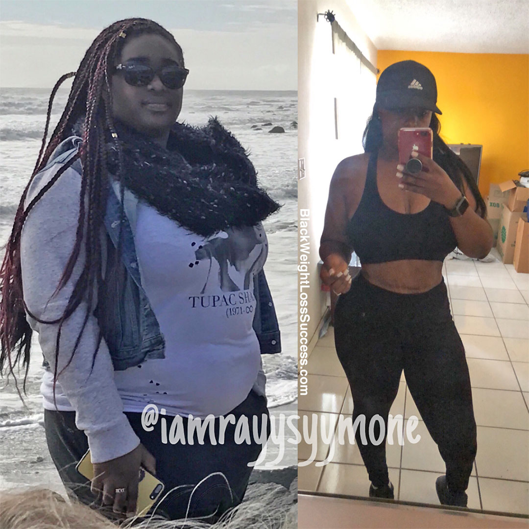 Rayy before and after