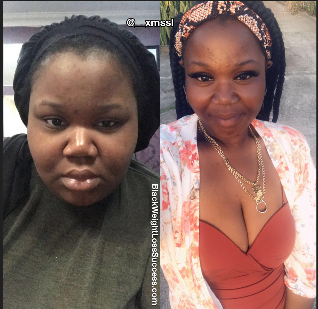 Shaneka before and after