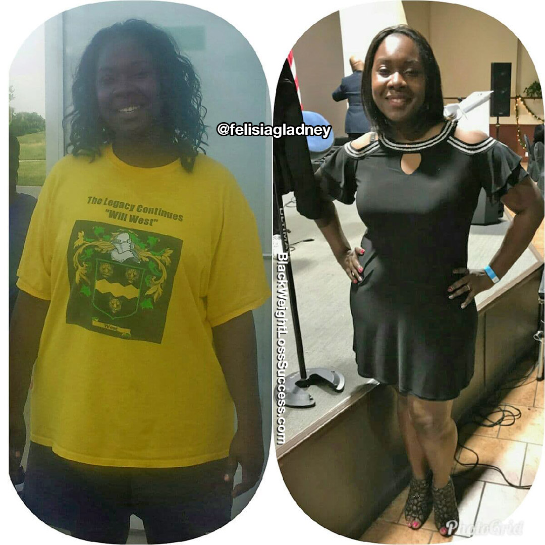 Felisia before and after
