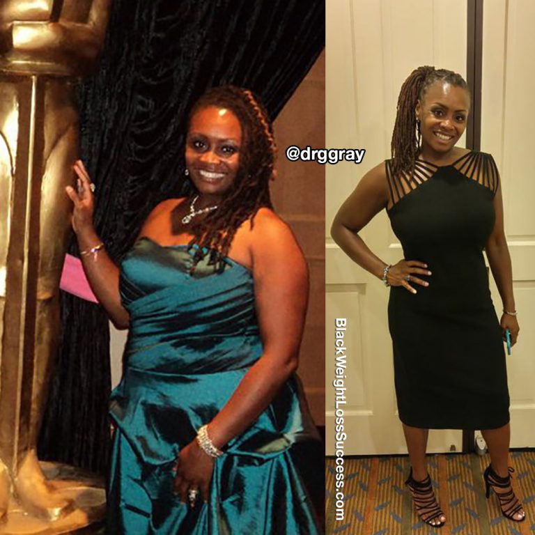 Dr. Geneva lost 50 pounds Black Weight Loss Success