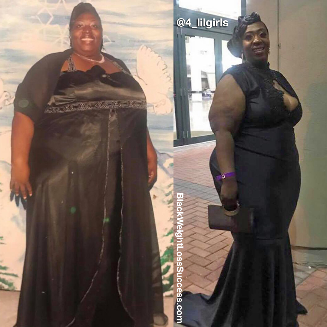 Patricia before and after