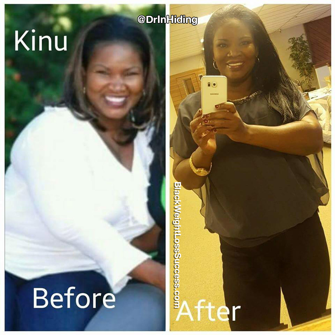 Kinu before and after