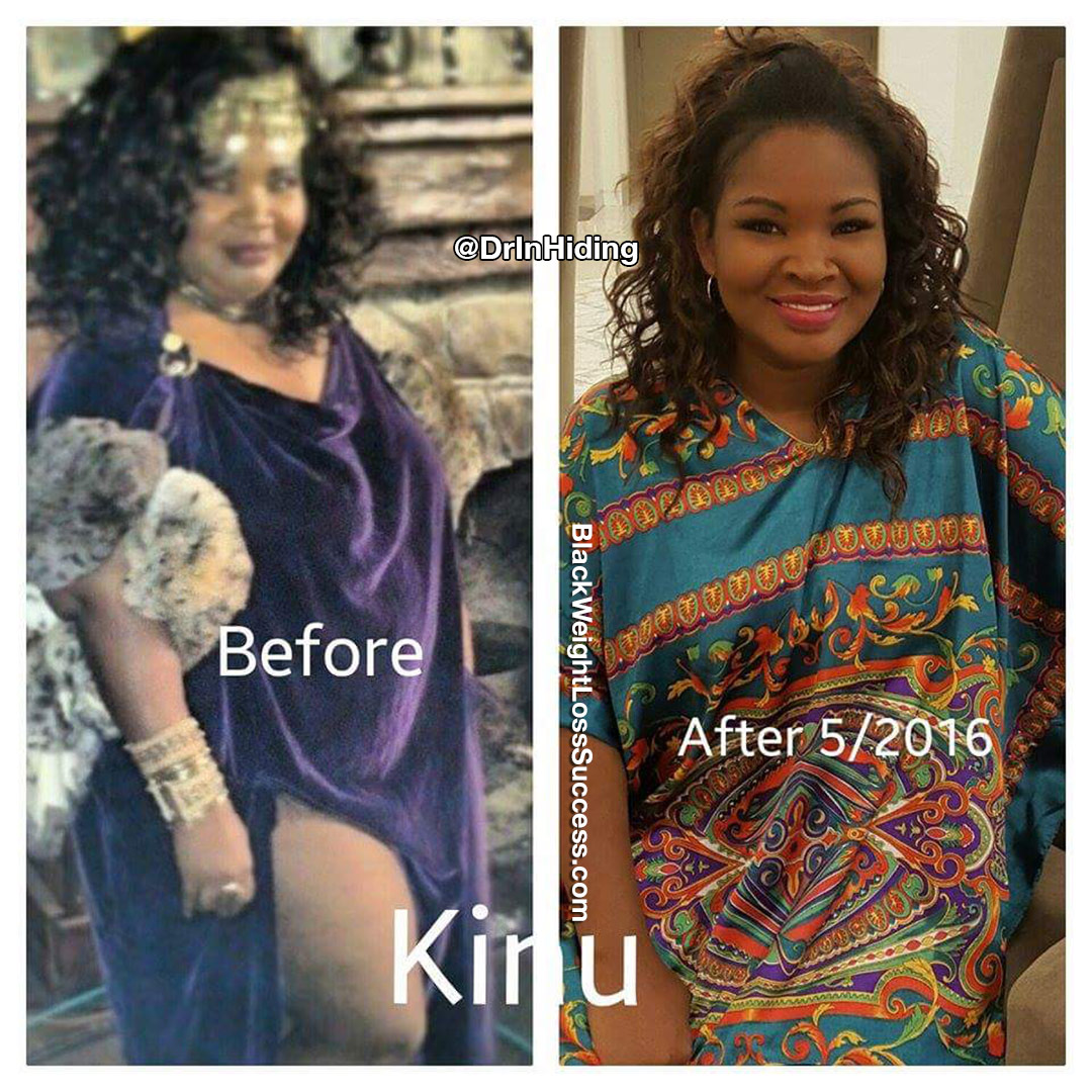 Kinu before and after