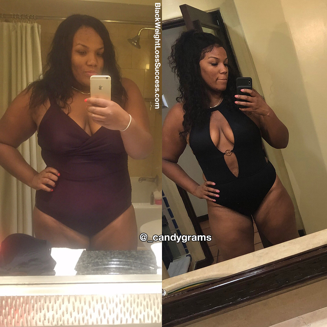Candice before and after