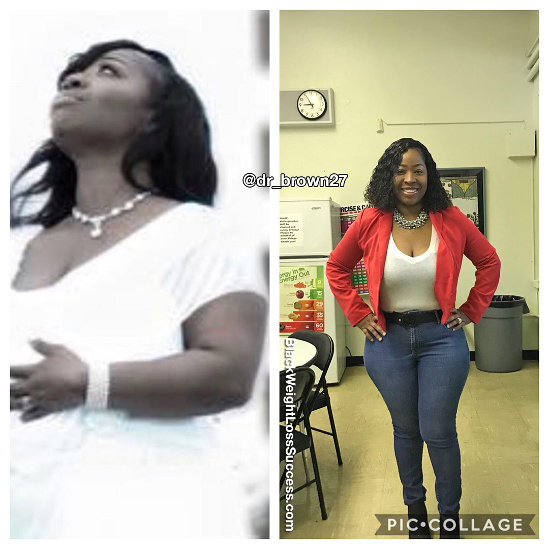 Sheneka before and after
