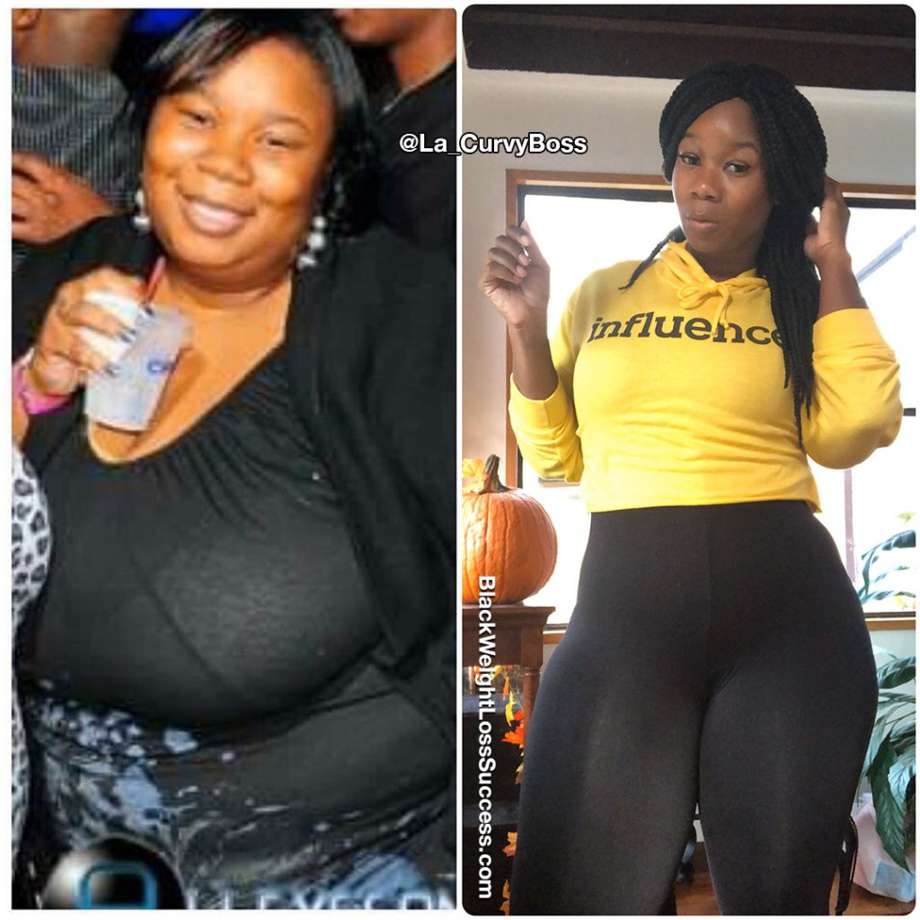 gastric bypass surgery Black Weight Loss Success