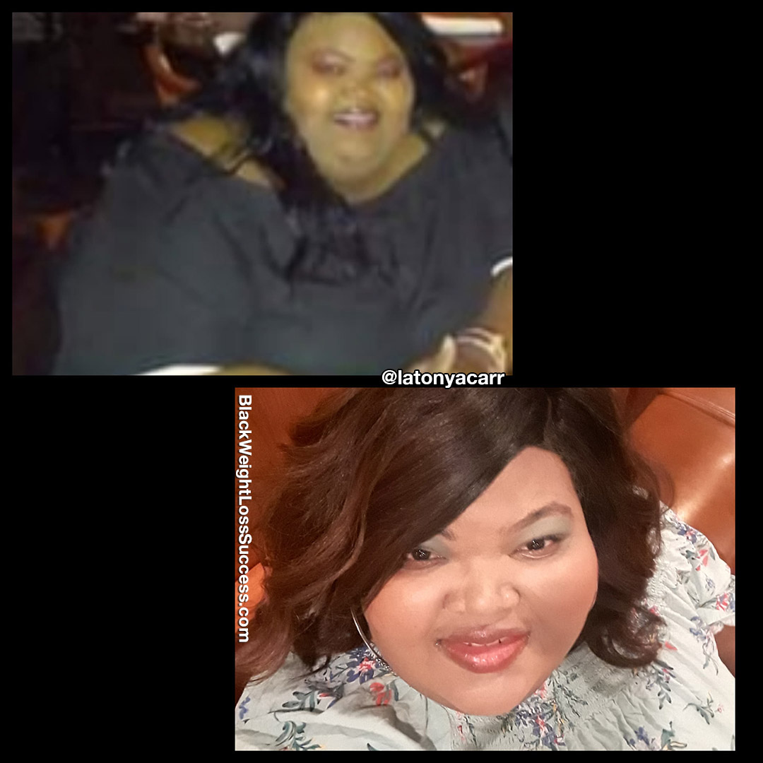 Latonya before and after