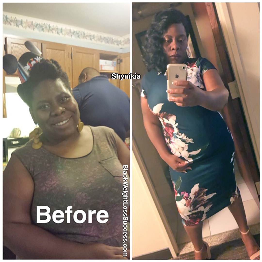 Shynikia lost 83 pounds | Black Weight Loss Success