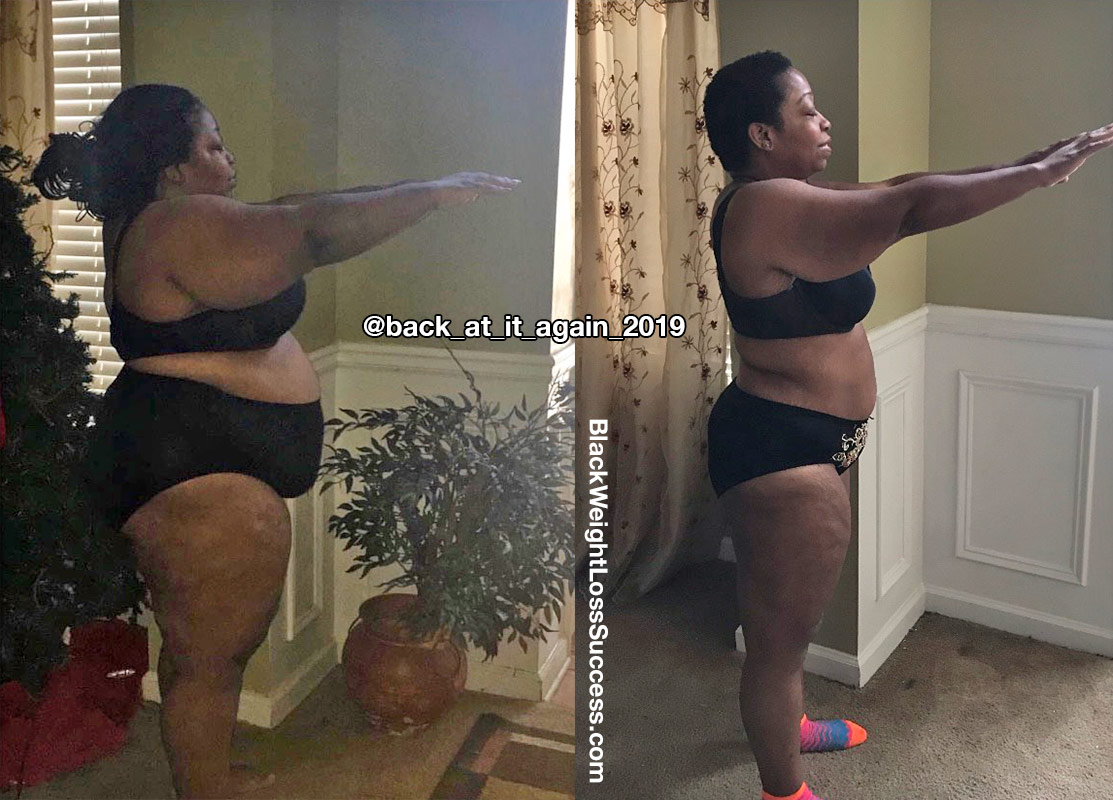 Nancy weight loss story