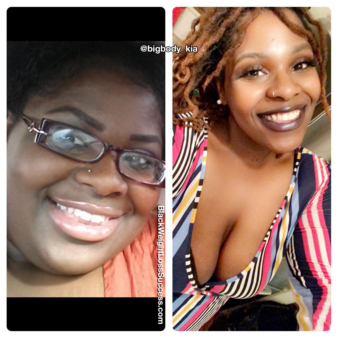 Shakia before and after