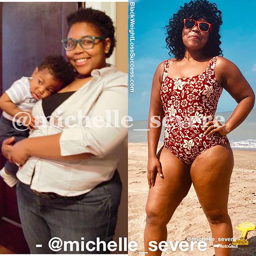 michelle before and after