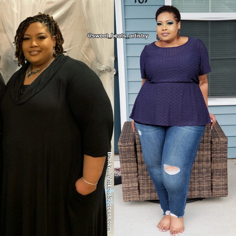 Vertical Sleeve Gastrectomy Black Weight Loss Success