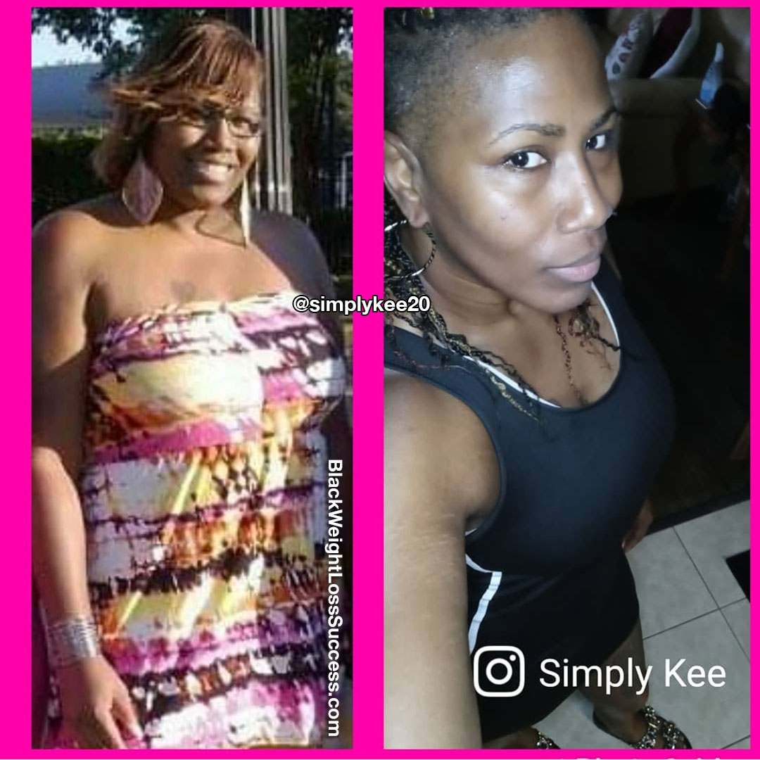Kee before and after