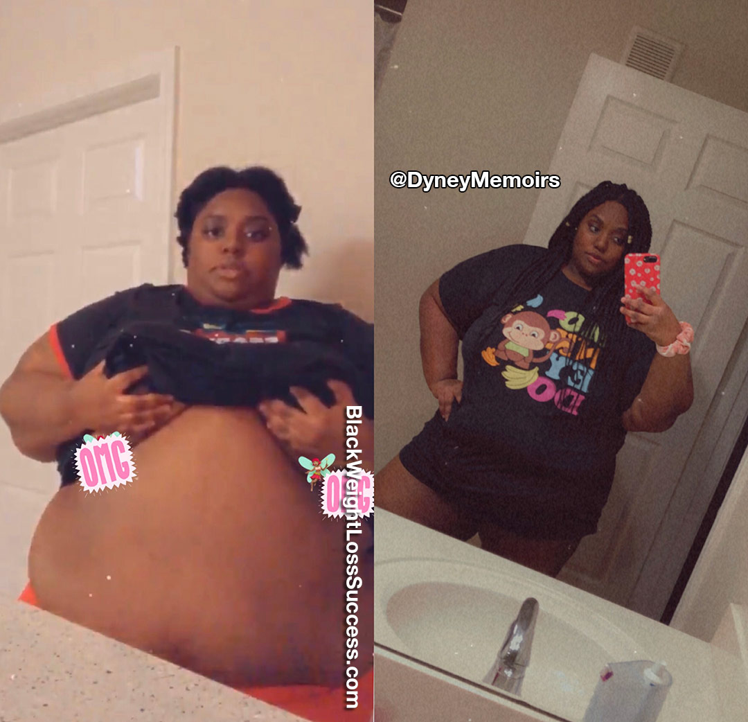 Dyney before and after weight loss