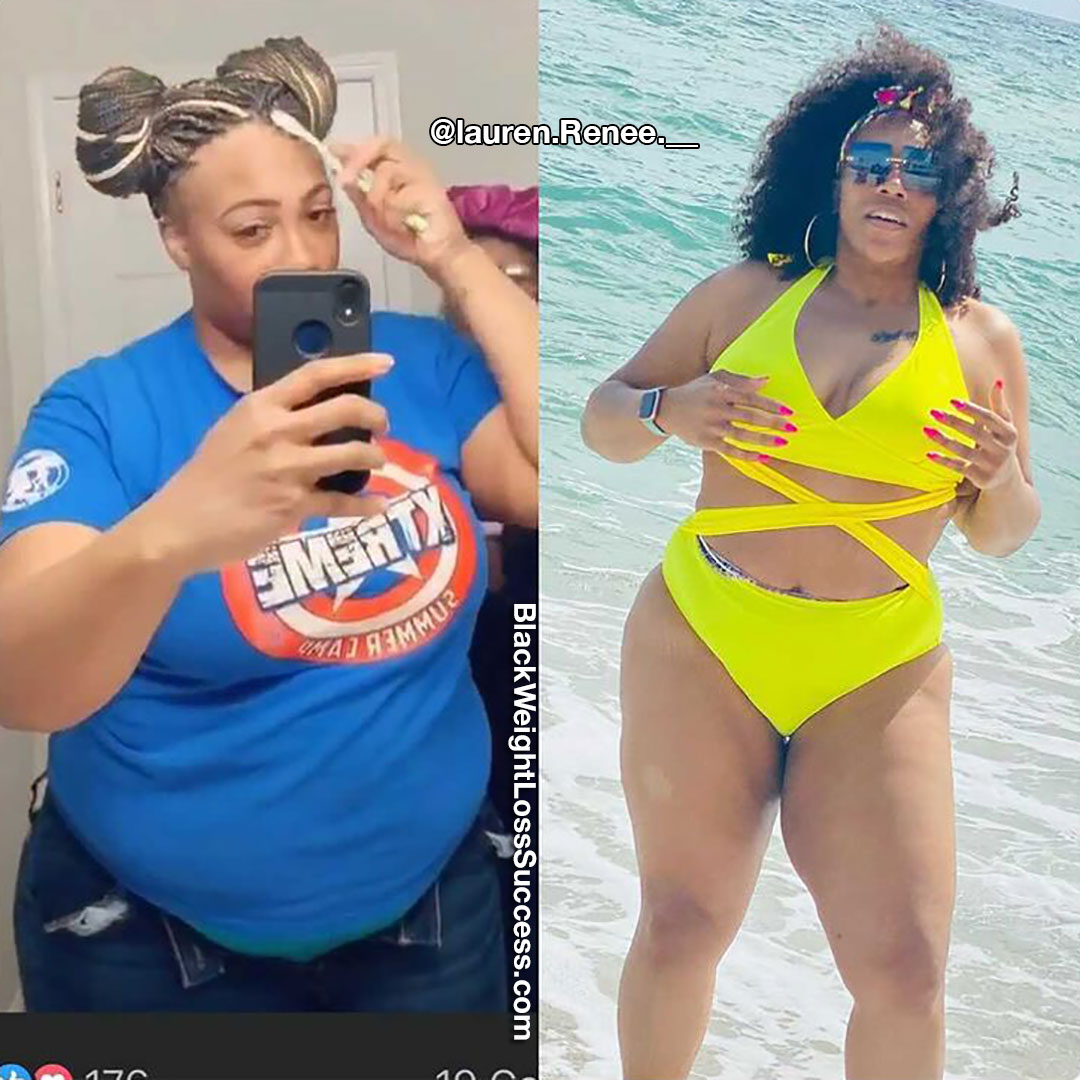 Lauren before and after weight loss