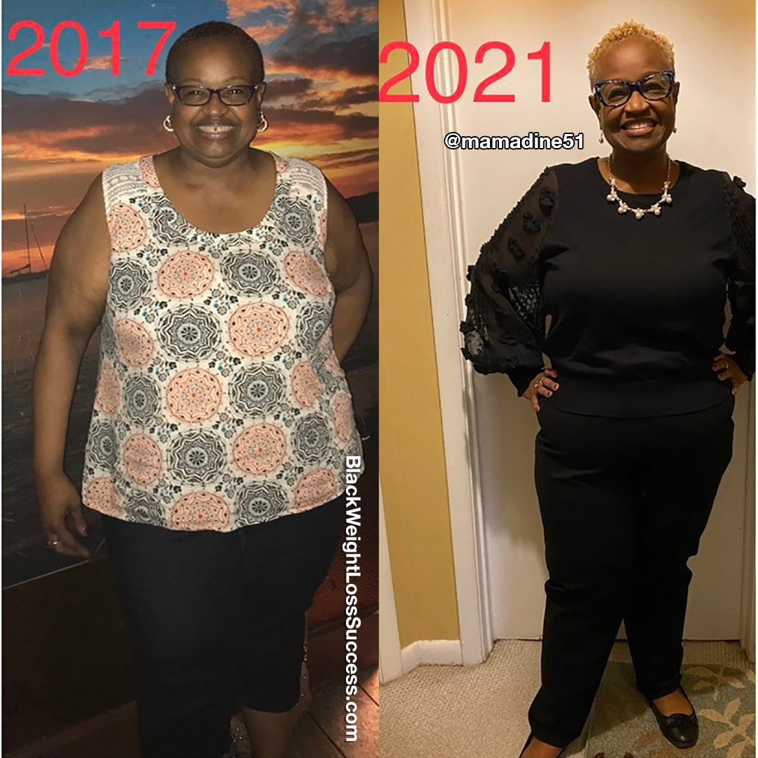 Geraldine before and after weight loss