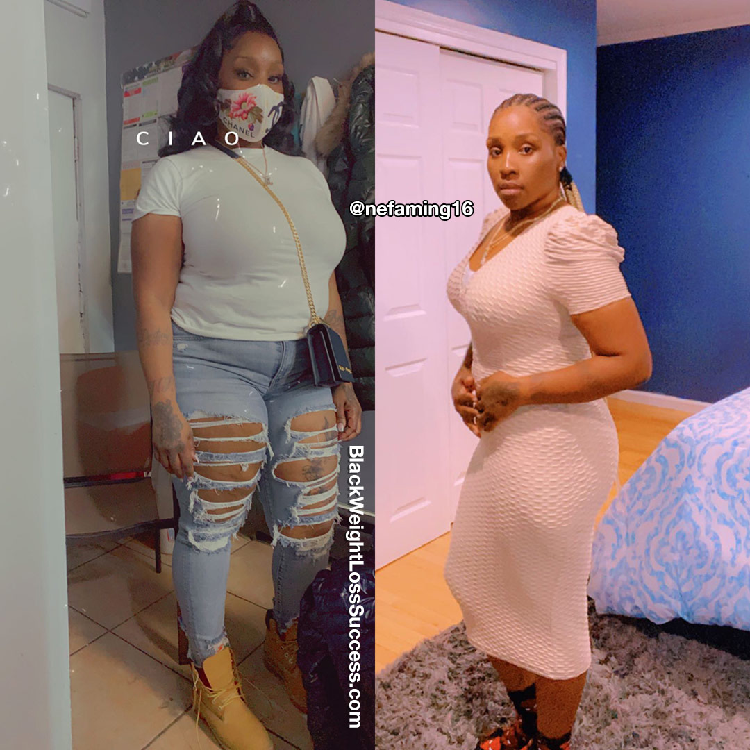 Nefa before and after weight loss