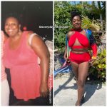 Stanice before and after weight loss