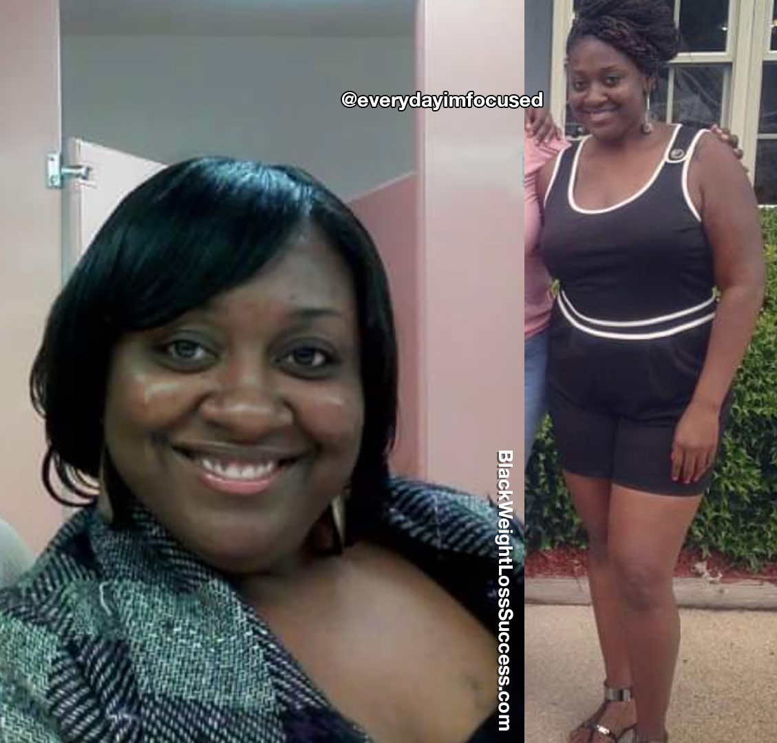 Stanice before and after weight loss