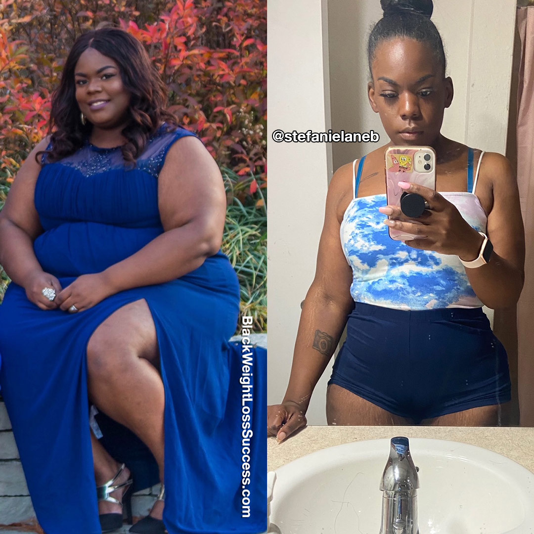 gastric bypass before and after black women