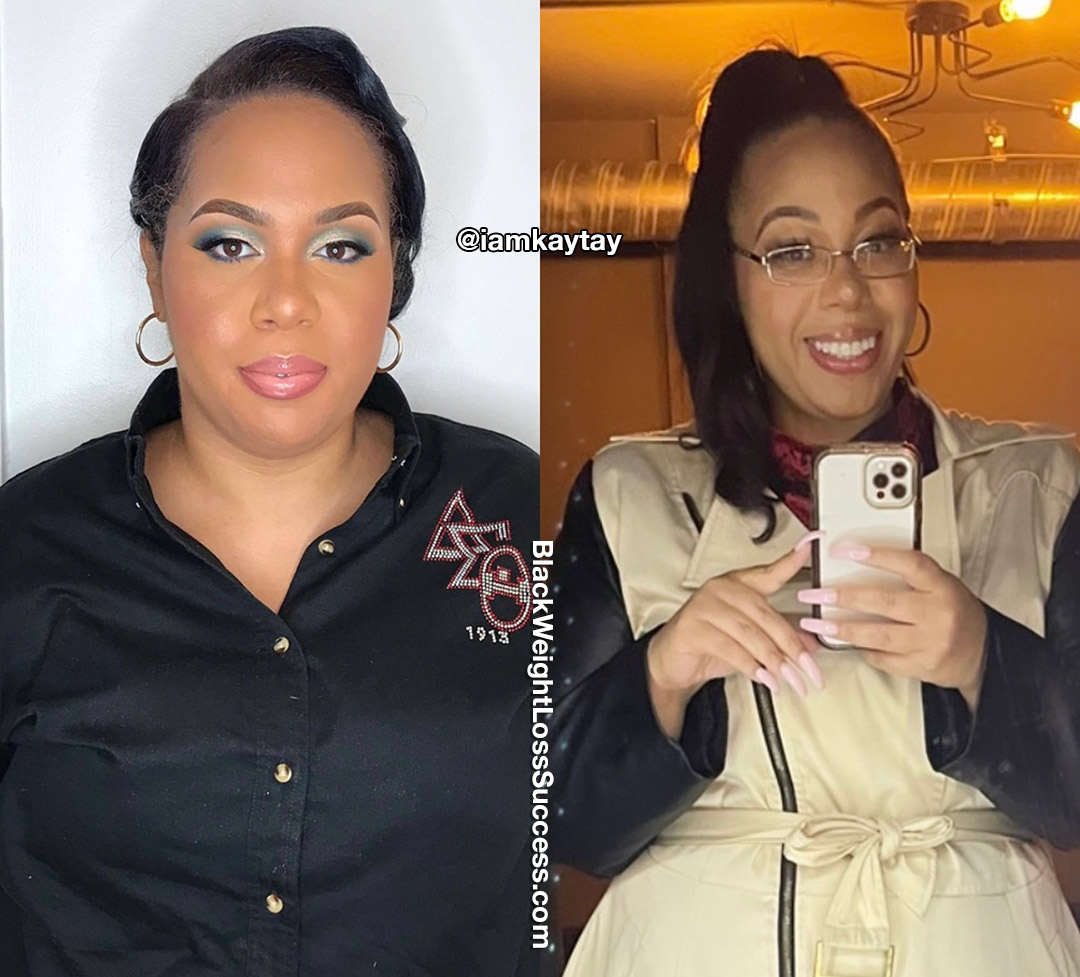 Kay before and after weight loss