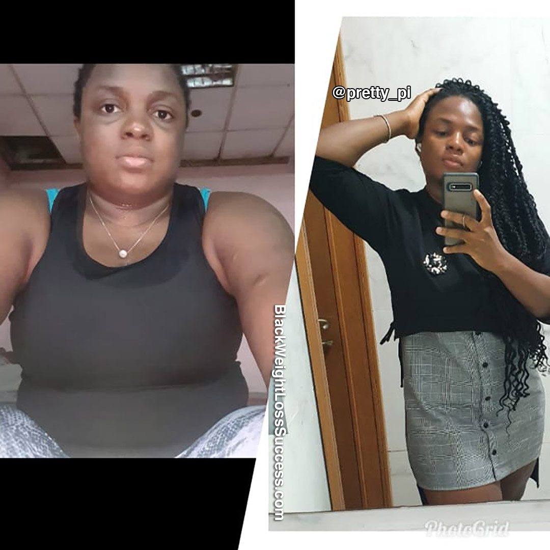 Precious before and after weight loss
