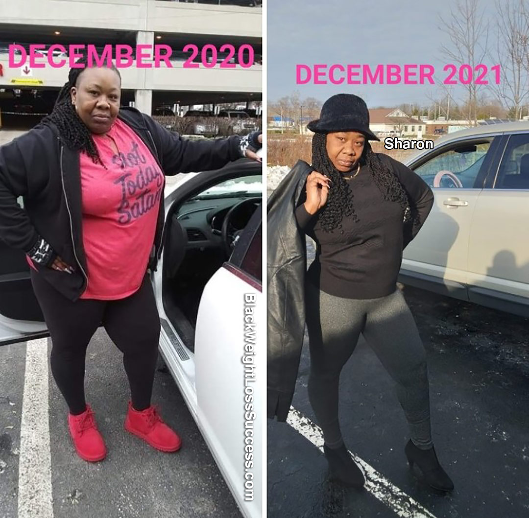 Sharon before and after weight loss