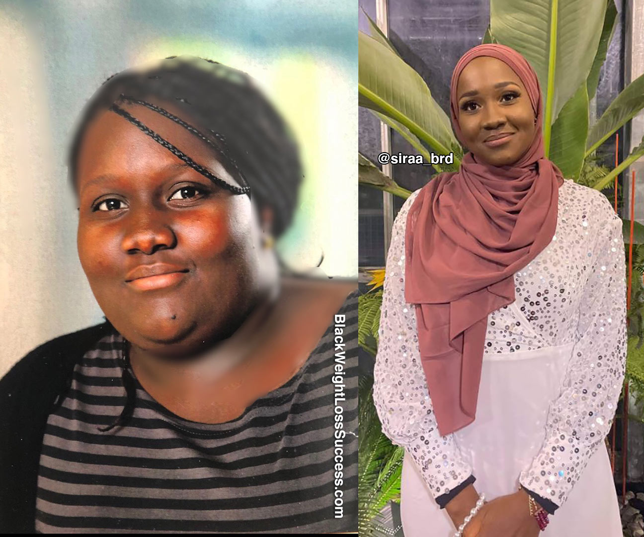 Siraa before and after weight loss