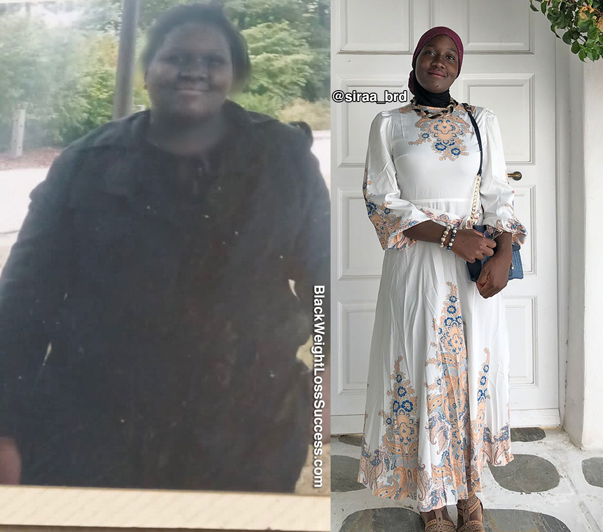 Siraa before and after weight loss
