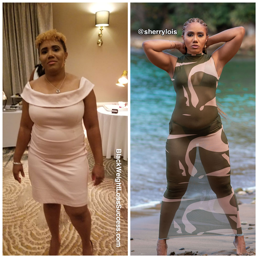 Sherrie before and after weight loss