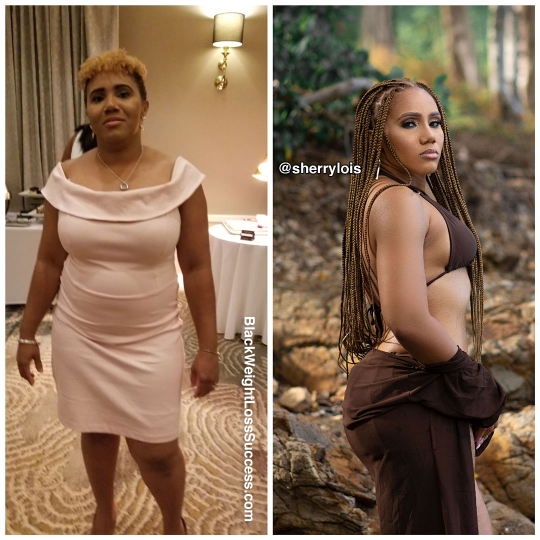 Sherrie before and after weight loss