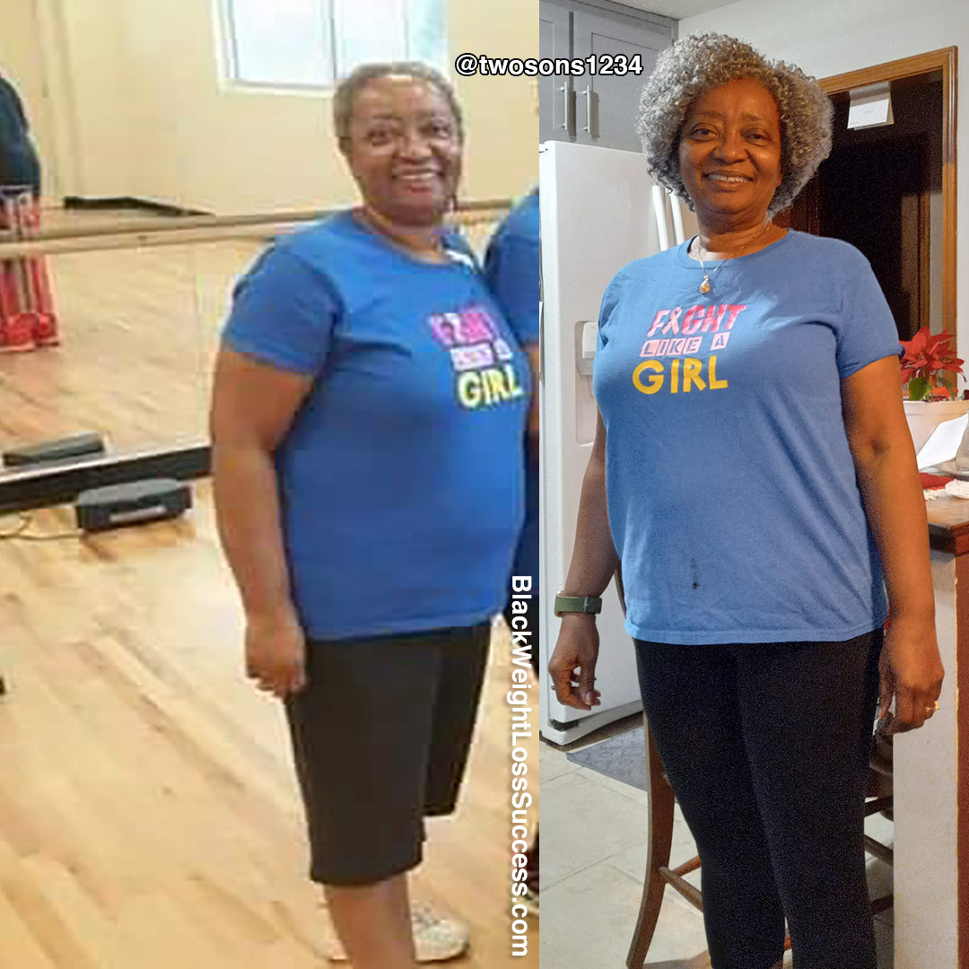 Helen before and after weight loss