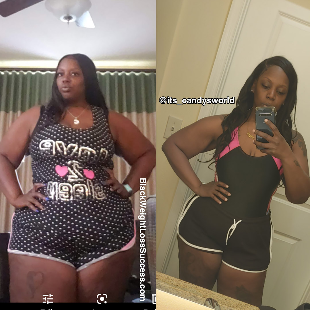 Candace before and after weight loss