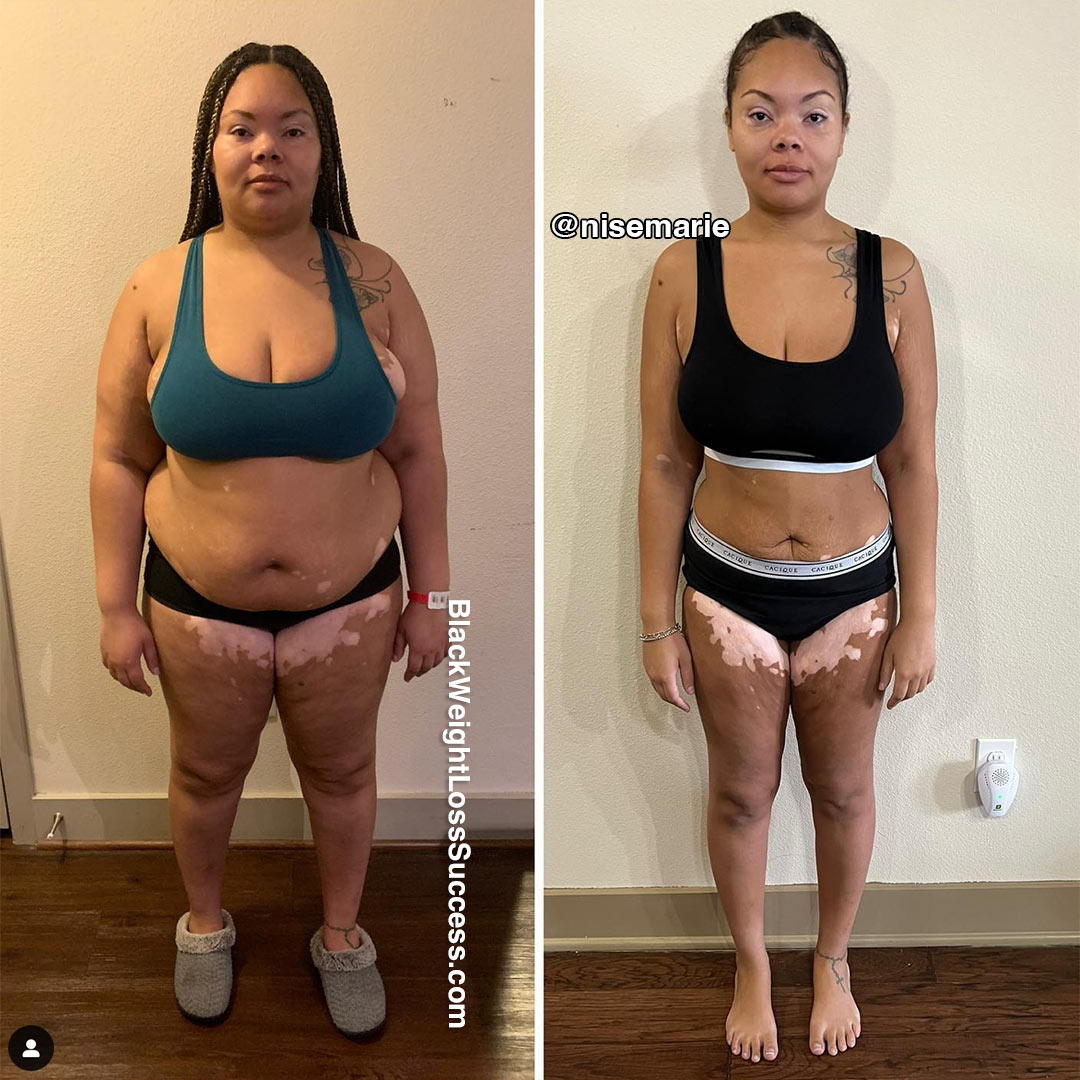 Lynise before and after weight loss