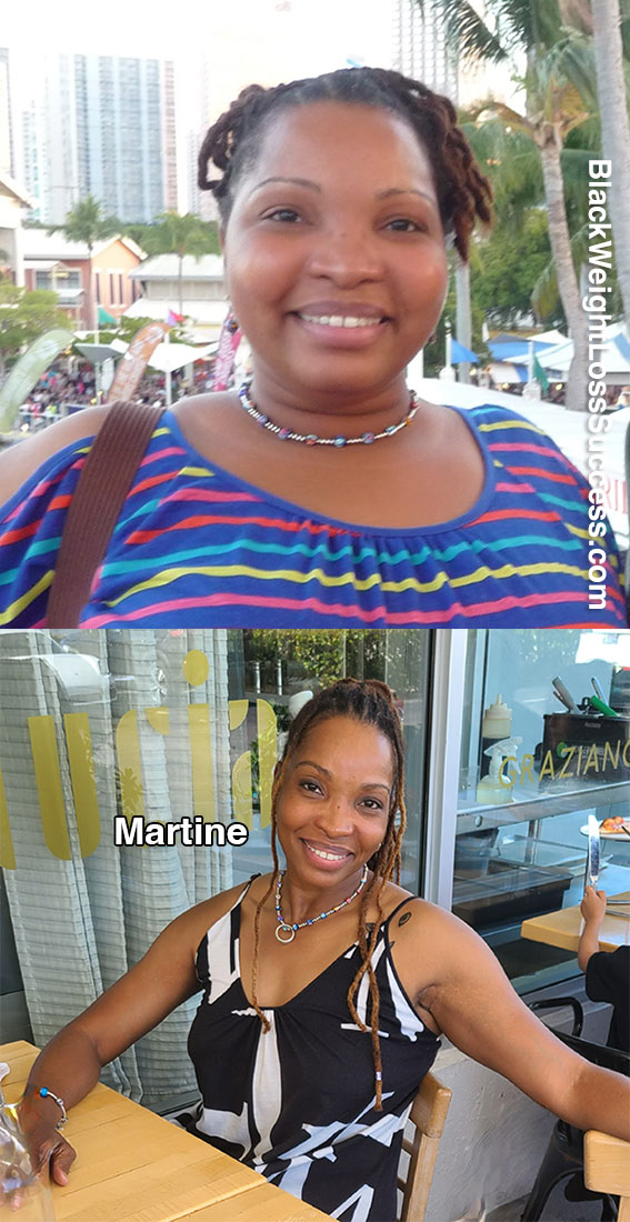 Martine before and after weight loss