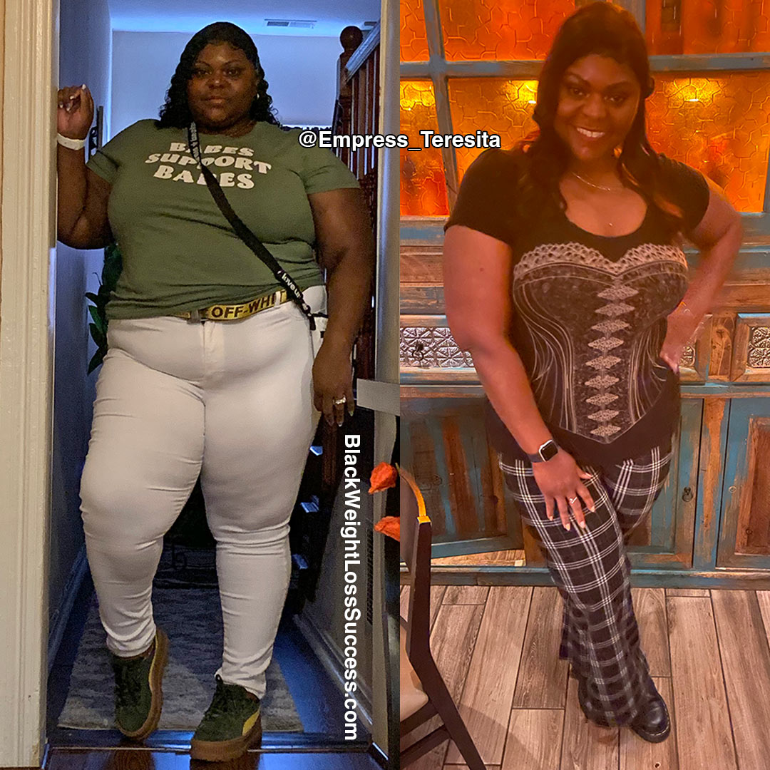 Teresita before and after weight loss