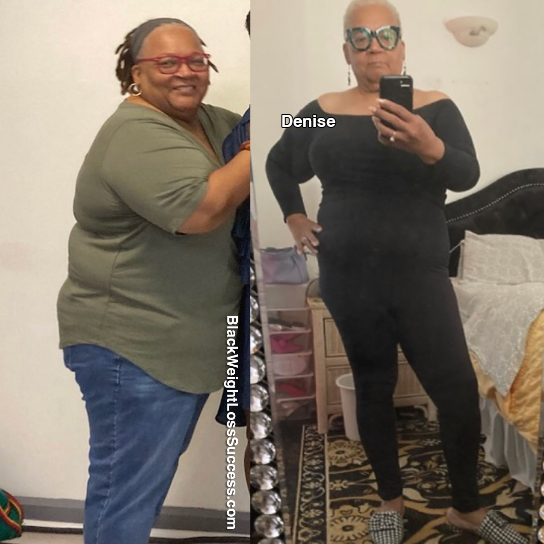 Denise before and after weight loss