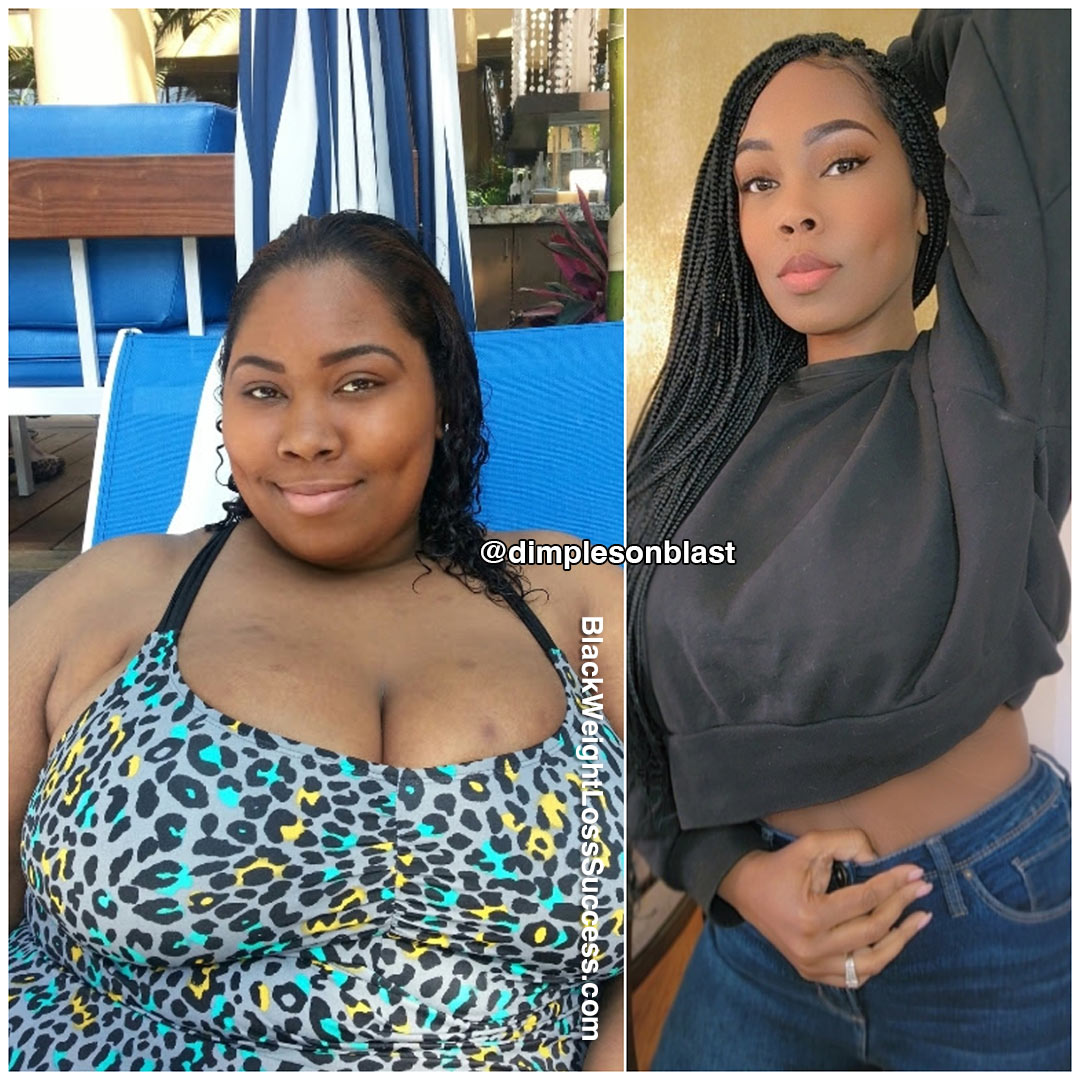 Naajma before and after weight loss