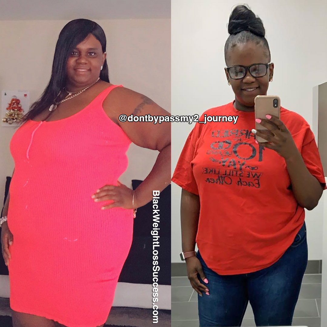 Devonna before and after weight loss