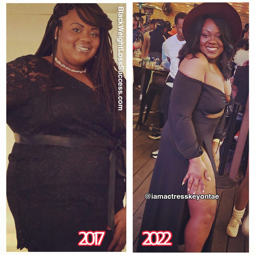 Keyontae lost 121 pounds - Black Weight Loss Success