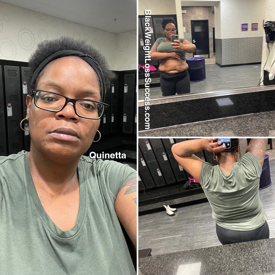Quinetta before and after weight loss